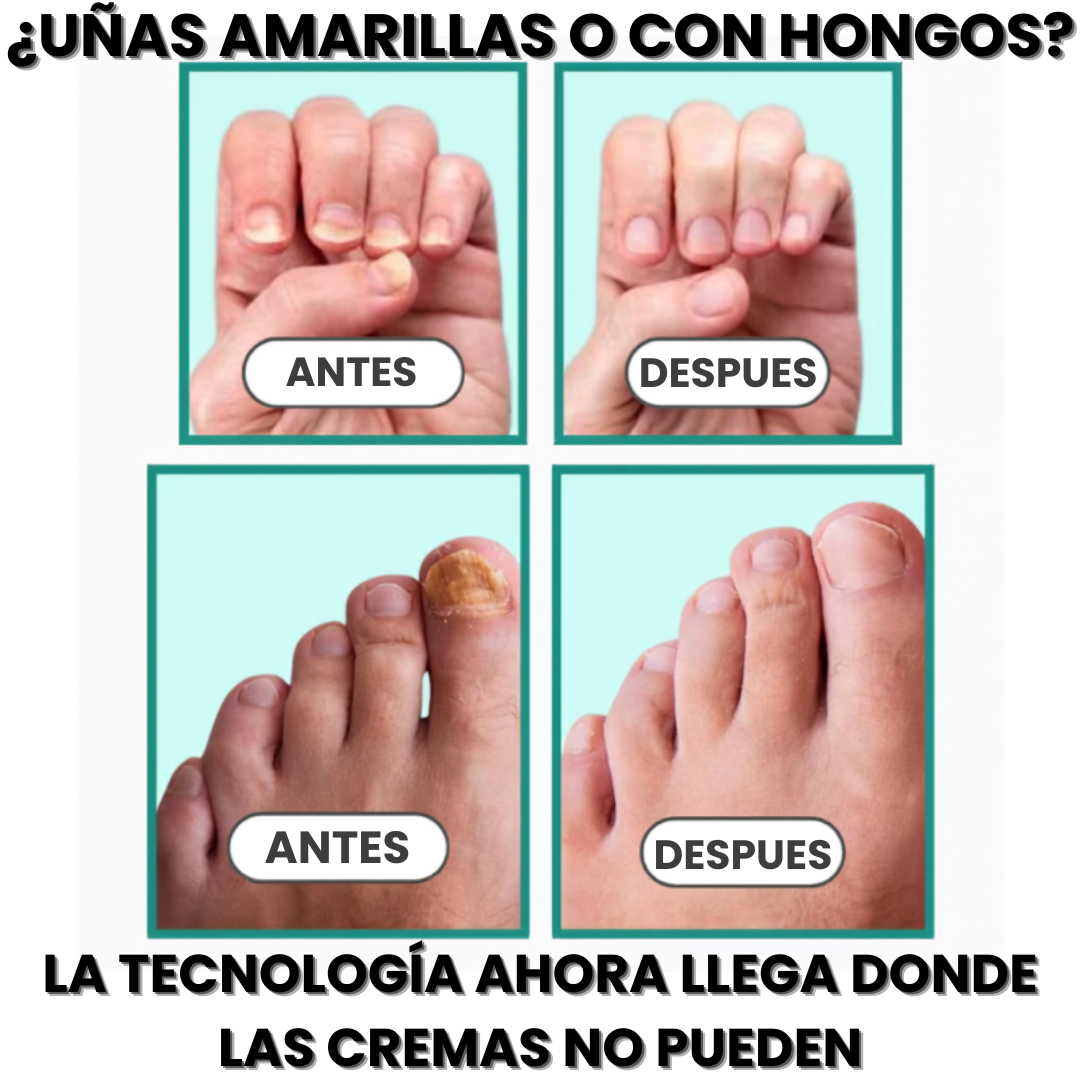 DermaLux | Donde las cremas no llegan