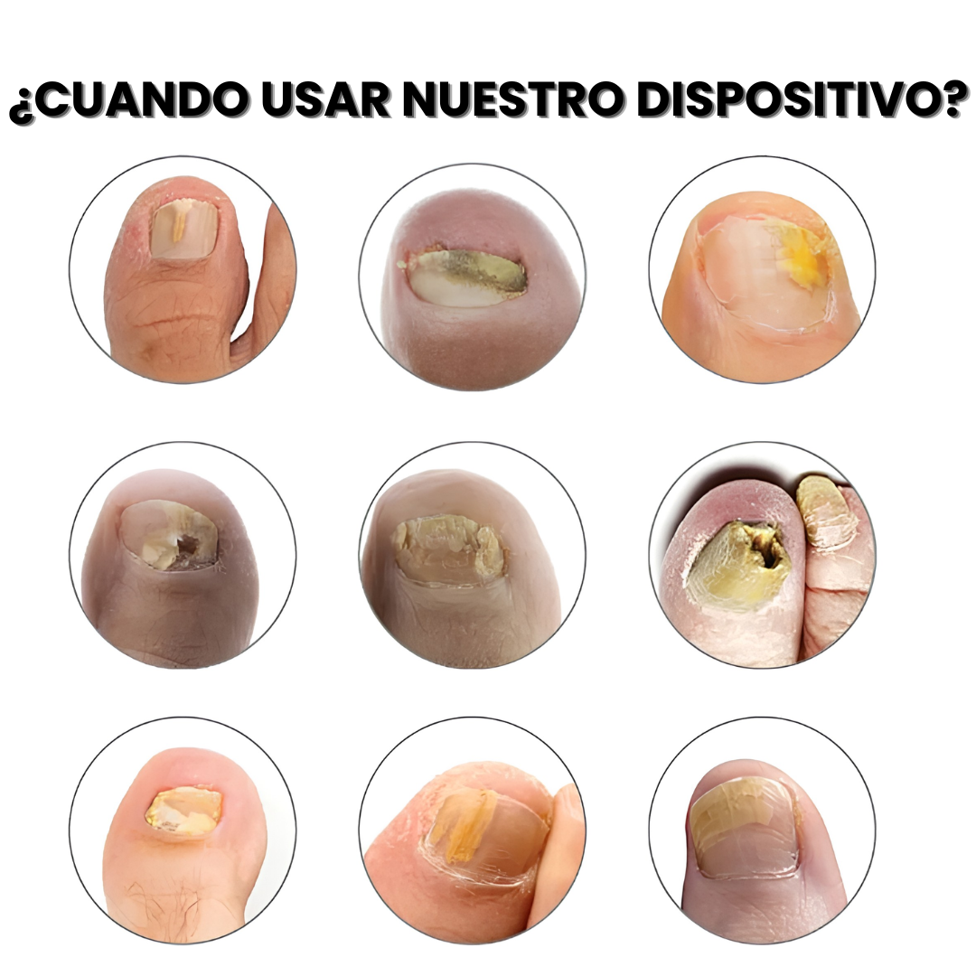 DermaLux | Donde las cremas no llegan