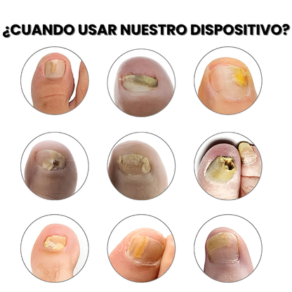 DermaLux | Donde las cremas no llegan
